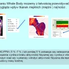 Przedsiębiorstwo 2 wizerunek BADANIE OSTEOPOROZY Poligrafia - Maszyny, Akcesoria w Kalisz WP
