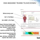 Przedsiębiorstwo 3 wizerunek BADANIE OSTEOPOROZY Poligrafia - Maszyny, Akcesoria w Kalisz WP