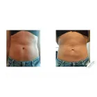 Przedsiębiorstwo 3 wizerunek KSZTAŁTOSFERA Rehabilitacja w Warszawa MZ