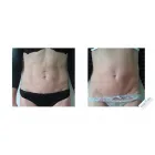 Przedsiębiorstwo 5 wizerunek KSZTAŁTOSFERA Rehabilitacja w Warszawa MZ