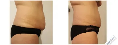 Przedsiębiorstwo 1 wizerunek KSZTAŁTOSFERA Rehabilitacja w Warszawa MZ