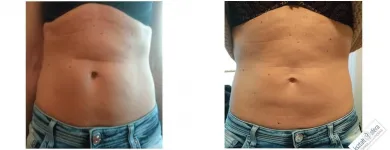 Przedsiębiorstwo 3 wizerunek KSZTAŁTOSFERA Rehabilitacja w Warszawa MZ