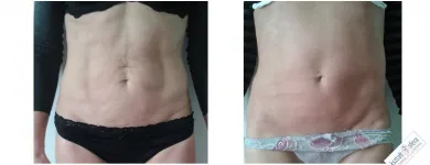 Przedsiębiorstwo 5 wizerunek KSZTAŁTOSFERA Rehabilitacja w Warszawa MZ